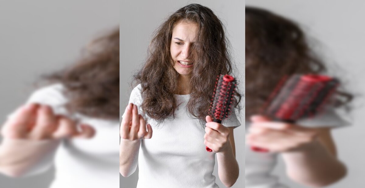 hairfall